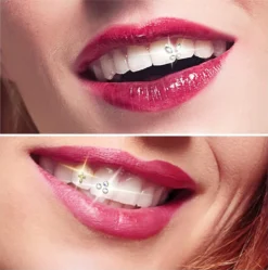 1 Satz Zähne Edelsteine Kit, Zahnwerkzeug Mit Aushärtungslicht Und Kleber Zahnschmuck Zähne Dekoration -Leifheit || Vileda || Wenko Verkaufsgeschäft 75545fae57ec45d090f42aadd097f268